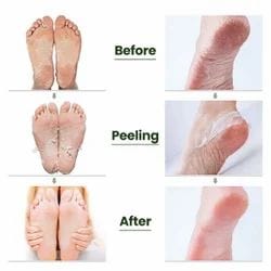 Peeling & Exfoliating Foot Mask for Baby Soft Feet