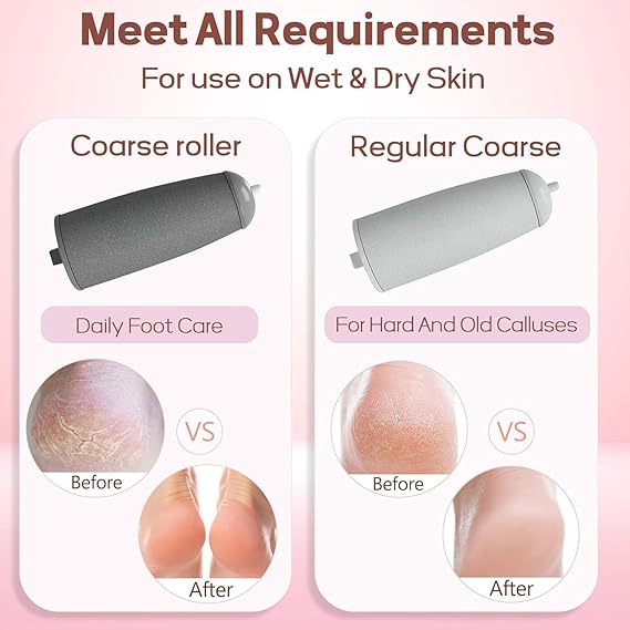 Callus Remover For Feet Dead Skin Remover